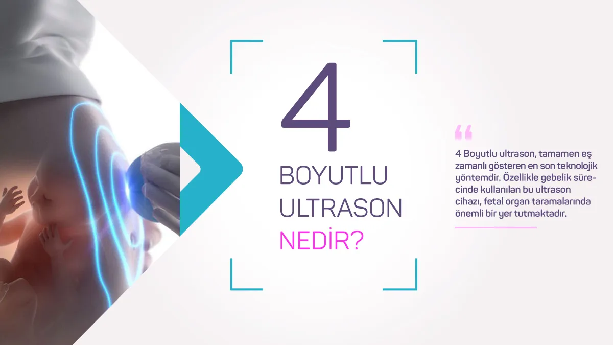 Gebelikte 4d ultrason
