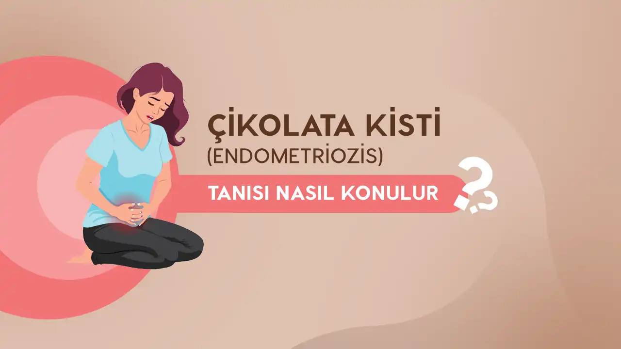 endometriozis tanisi nasil konulur