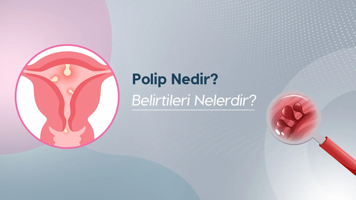 Polip ameliyatı konusunda rahim içi polipleri ve belirtilerini anlatan çizim